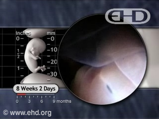 Play Movie - Eyelid Fusion Play Movie - Eyelid Fusion